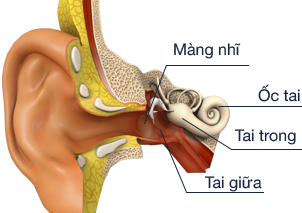 thế nào là viêm tai giữa