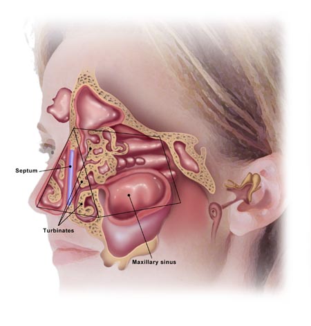 Điều trị và phòng ngừa polyp mũi