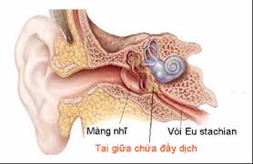 Viêm tai giữa là gì?