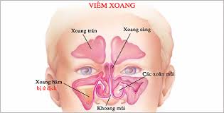 Qủa mướp chữa bệnh viêm xoang thần kỳ