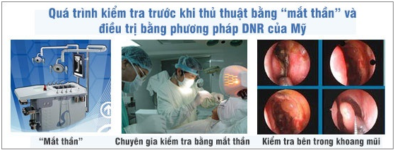 viêm mũi dị ứng