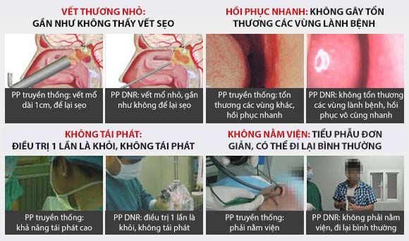 Trải nghiệm công nghệ chữa bệnh viêm xoang hiện đại nhất