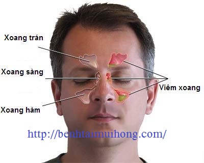 Truy tìm ” thủ phạm” gây bệnh viêm xoang