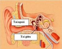 Làm sao để phân biệt viêm tai ngoài và viêm tai giữa đây?