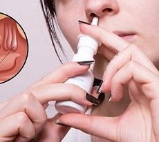 Polyp mũi và những mối nguy hại mà bạn phải “đối mặt”